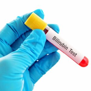 Bilirubine