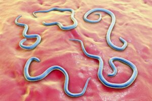 Vers intestinaux