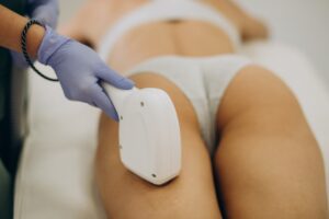 Peau lisse avec épilation définitive